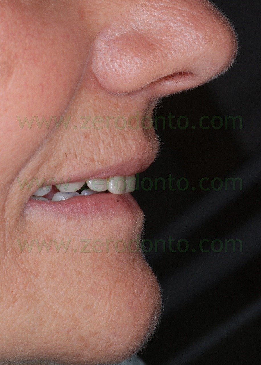 [profilo%2520prova%2520estetica%255B1%255D.jpg]