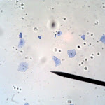 cell_cheek_01.jpg