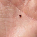 Sheep tick
