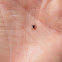 Sheep tick