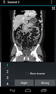 How to mod Radiology Flashcards: General2 1.4 unlimited apk for pc