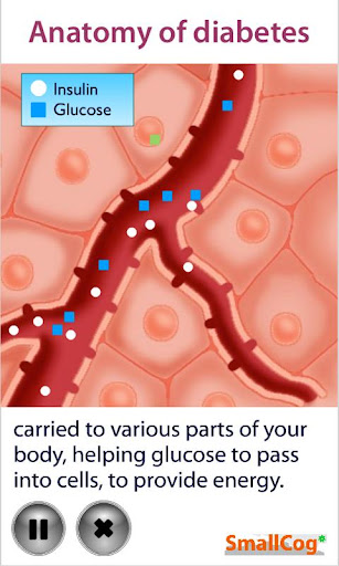 Anatomy of Diabetes