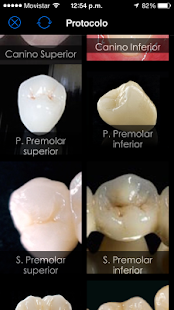 How to get DentlApp 1.0 mod apk for android