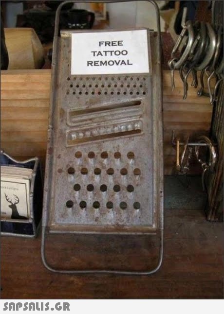 FREE TATTO0 REMOVAL 