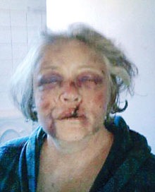 [KotieMostertApril112008BalfourFarmAttackVictimPolicePhoneLinesOut[3].jpg]