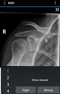 How to mod Radiology Flashcards: MSK 1.4 mod apk for pc