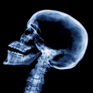 Death Rules The World Atom.apk 1.1