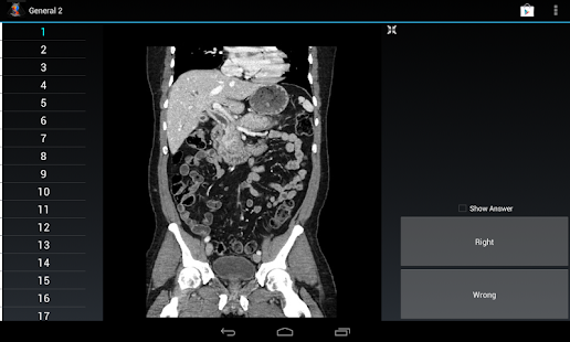 How to get Radiology Flashcards: General2 lastet apk for pc