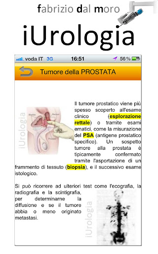 【免費醫療App】iUrologia-FDM-APP點子