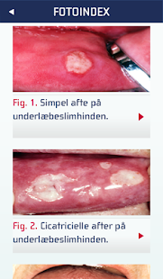 How to download OralMedicin lastet apk for android