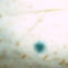 Mold