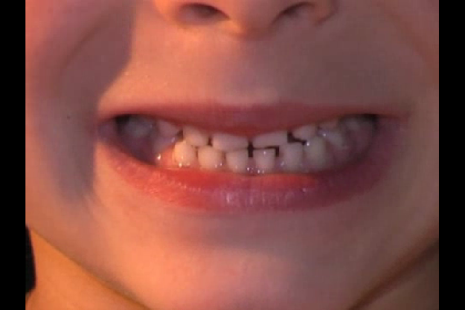 How to install Говорим Л, Ль правильно lastet apk for android