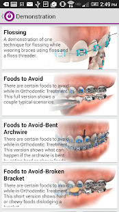 How to download Edge Animations 1.1.7 unlimited apk for bluestacks