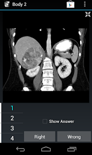How to download Radiology Flashcards: Body 2 patch 1.4 apk for bluestacks