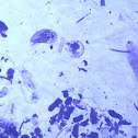 Ostracod and egg