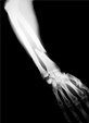 An Overview of Musculoskeletal Trauma - Treatment & Care