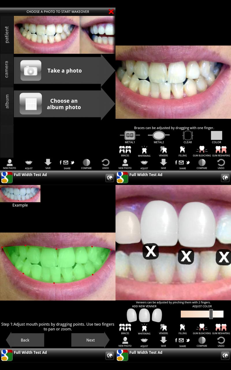 Android application Virtual Dentist screenshort