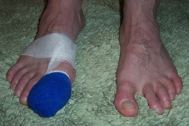 [bandaged toe (9)[3].jpg]