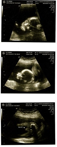[ultrasound[4].jpg]