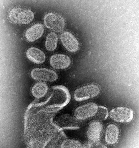 [EM_of_influenza_virus3.jpg]