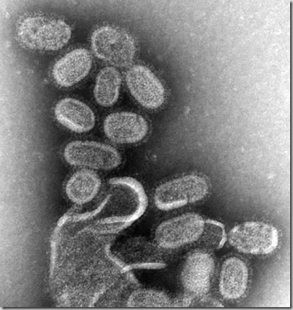 EM_of_influenza_virus