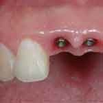 [dentsem150[3].jpg]
