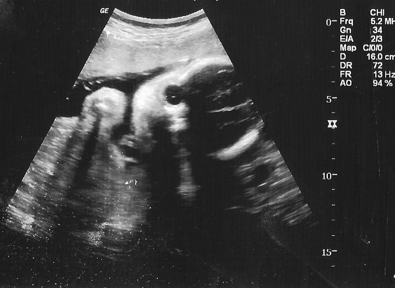 Jack ultrasound 2