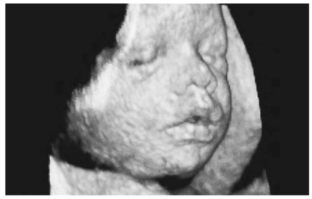 By the eighteenth week of pregnancy, ultrasound technology can detect many ...