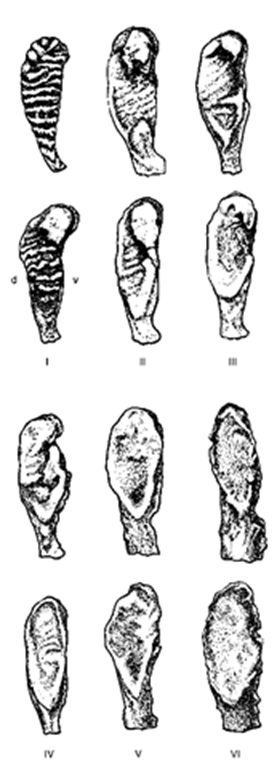 Suchey-Brooks pubic symphyseal phases (I—VI). V, ventral side. Redrawn from Burch and Suchey, 1986