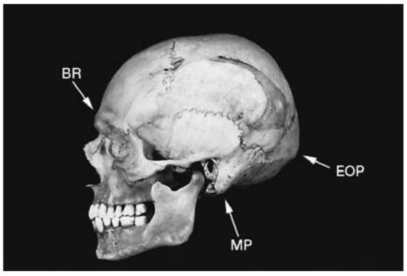 Male cranium. BR, brow ridge; MP,mastoid process; EOP, external occipital protuberance.