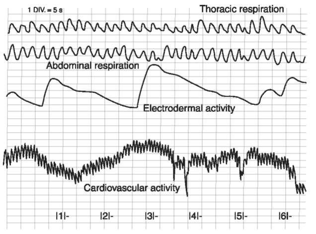 Illustration of respiration, electrodermal and cardiovascular patterns of recording on a chart.