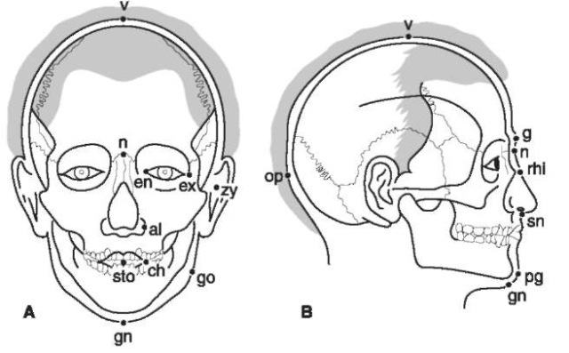  (A) Frontal and (B) lateral views of the head showing landmarks for the examination of consistency between a skull and a facial photograph by the superimposition method, al, Ala; ch, cheilion; en, entocanthion; ex, ectocanthion; g, glabella; gn, gnathion; go, gonion; n, nasion; op, opisthocranion; pg, pogo-nion; rhi, rhinion; sn, subnasale; sto, stomion; v, vertex; zy, zygion,