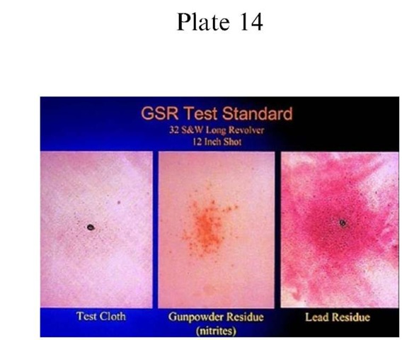 Plate 14 CLINICAL FORENSIC MEDICINE/Evaluation of Gunshot Wounds The forensic laboratory can use tests to detect the presence of vaporized lead and nitrates. These tests will assist the forensic investigator in determining the range of fire.