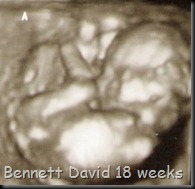 bennett 3d