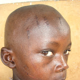 &ndash; Osman Kamara lives in the area of Freetown called Bay. He bares scars on his face from a beating for inquiring about going to school, it would deprive the family of the income from selling charcoal if he went to school. (©NHA photo James Mansaray 7 June 2007)