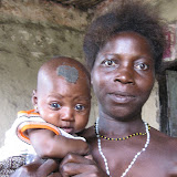  &ndash; When I questioned James about the spot of this poor child's head. James answered "its a hole in her head from an injury" © NHA, J Mansaray 2007