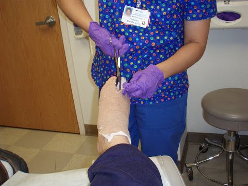 hammertoe and bunion surgery exercises