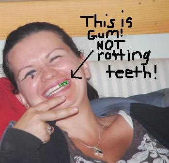 [gum not rotting teeth[2].jpg]