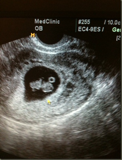 ultrasound dec 16