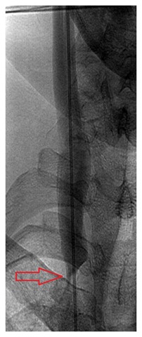 [RIJV angiogram 01[2].jpg]