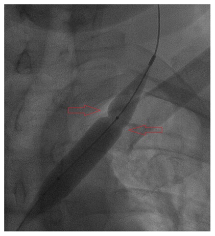 [LIJV full inflate 01[2].jpg]