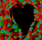 Mathieu-Benoit Voisin y Doris Proebstl
Instituto de Investigación William Harvey (Londres)
Un corazón bajo el microscopio. Ésta es la sorprendente forma que se encontraron de casualidad los científicos premiados mientras observaban cómo las células sanguíneas acuden a reparar los daños en el tejido cardiaco. "Al entender mejor cómo los glóbulos blancos interactúan con los componentes de los vasos sanguíneos, esperamos identificar nuevas avenidas para solucionar las patologías del sistema circulatorio", señalan los autores para explicar esta imagen ganadora. Mathieu-Benoit Voisin y Doris Proebstl
Instituto de Investigación William Harvey (Londres)
Un corazón bajo el microscopio. Ésta es la sorprendente forma que se encontraron de casualidad los científicos premiados mientras observaban cómo las células sanguíneas acuden a reparar los daños en el tejido cardiaco. "Al entender mejor cómo los glóbulos blancos interactúan con los componentes de los vasos sanguíneos, esperamos identificar nuevas avenidas para solucionar las patologías del sistema circulatorio", señalan los autores para explicar esta imagen ganadora.
