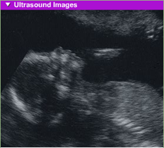 fetal development 5th month usg