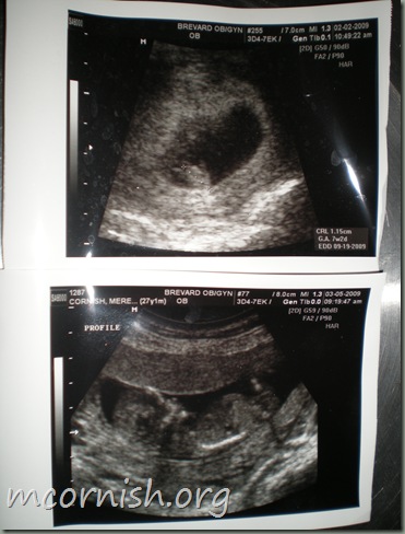 ultrasounds at 8 weeks. 8 weeks vs 12 weeks