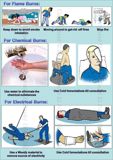first aids of burn first aids of burn