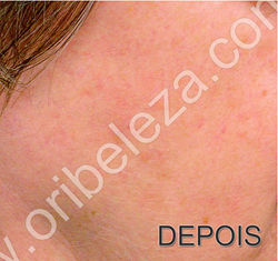 Gama Despigmentante Optimals Even Out da Oriflame