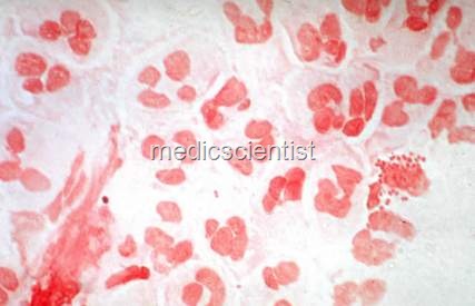 [Gram-Negative 1[2].jpg]
