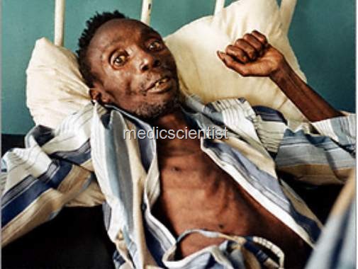 [AIDS (Acquired Immunodeficiency Syndrome)sd[2].jpg]