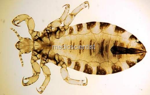 [EPIDEMIC TYPHUS ss[2].jpg]