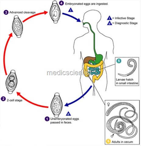 [TRICHURIS TRICHURA (WHIP WORM) jh[2].jpg]